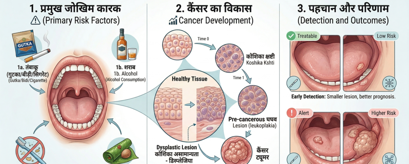 Mouth Cancer Kaise Hota Hai