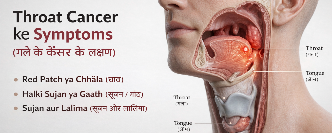 throat-cancer-symptoms