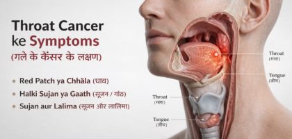 throat-cancer-symptoms-in-hindi