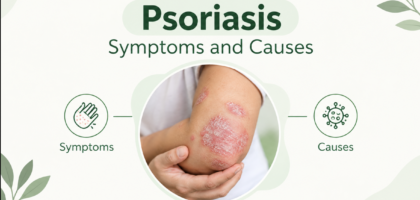 Psoriasis symptoms showing red, scaly patches on the elbow